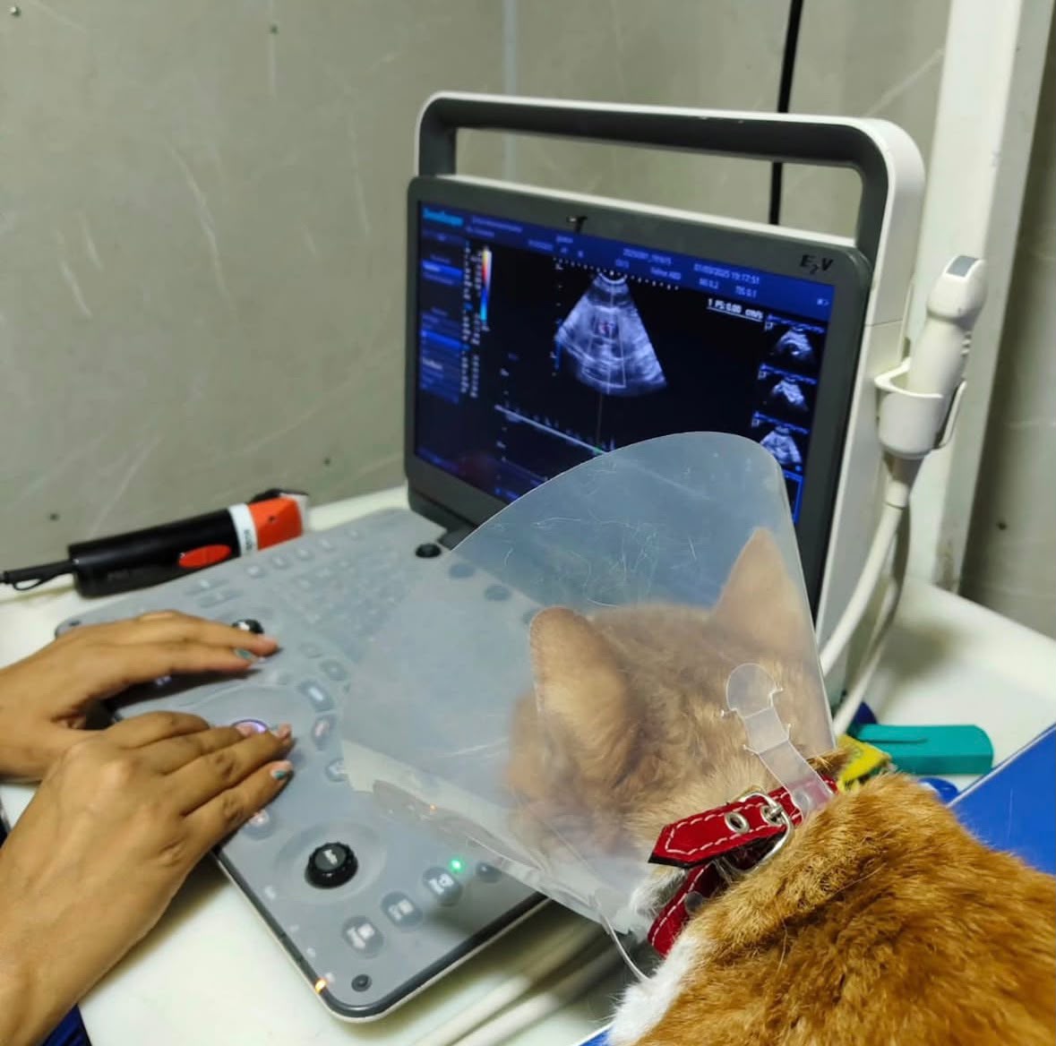 Ecografía abdominal