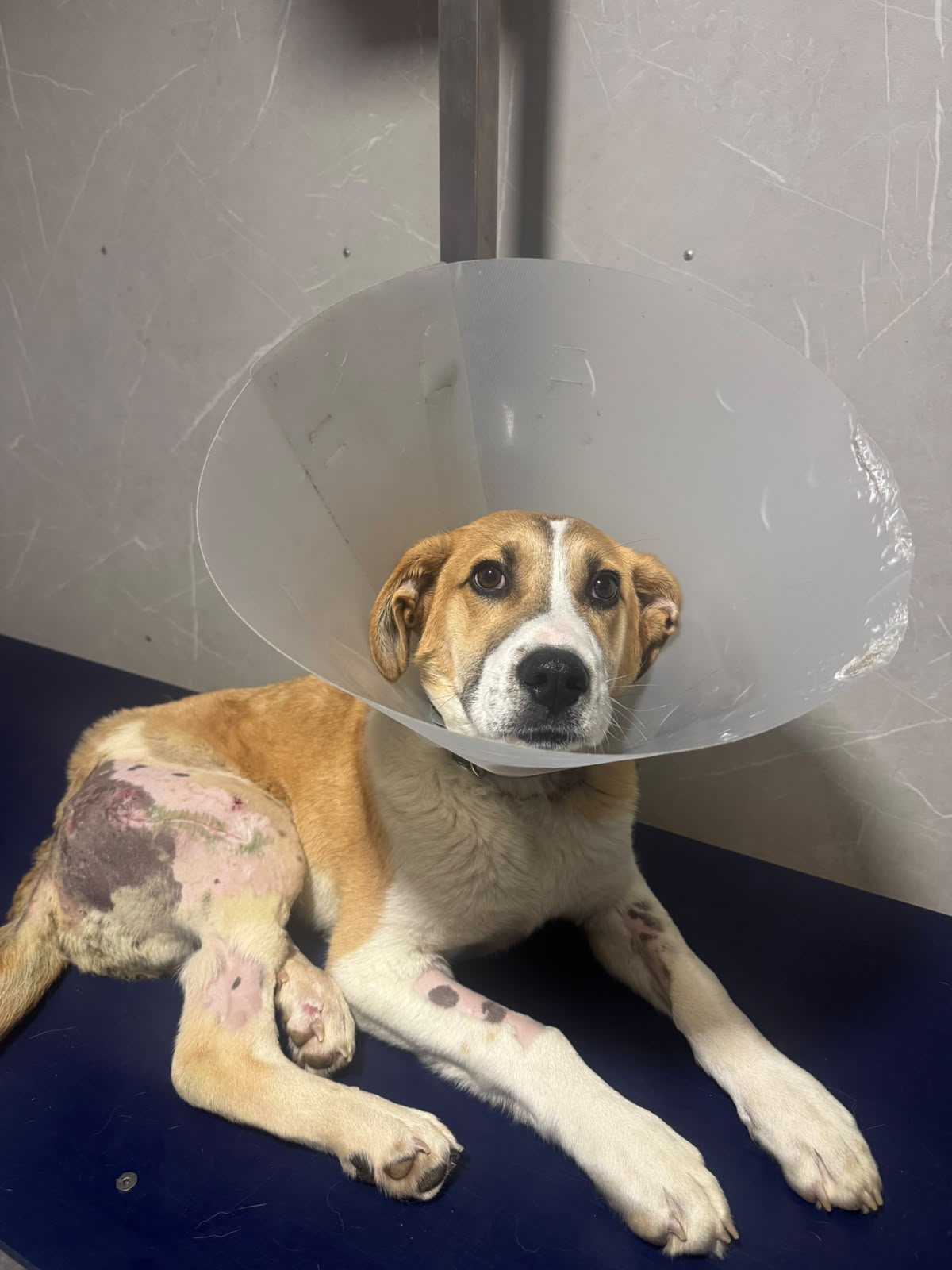 Recuperación post-quirúrgica